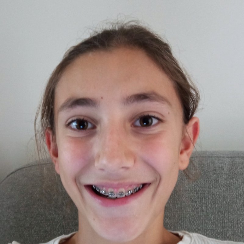ANE FRIAS LEKUONA