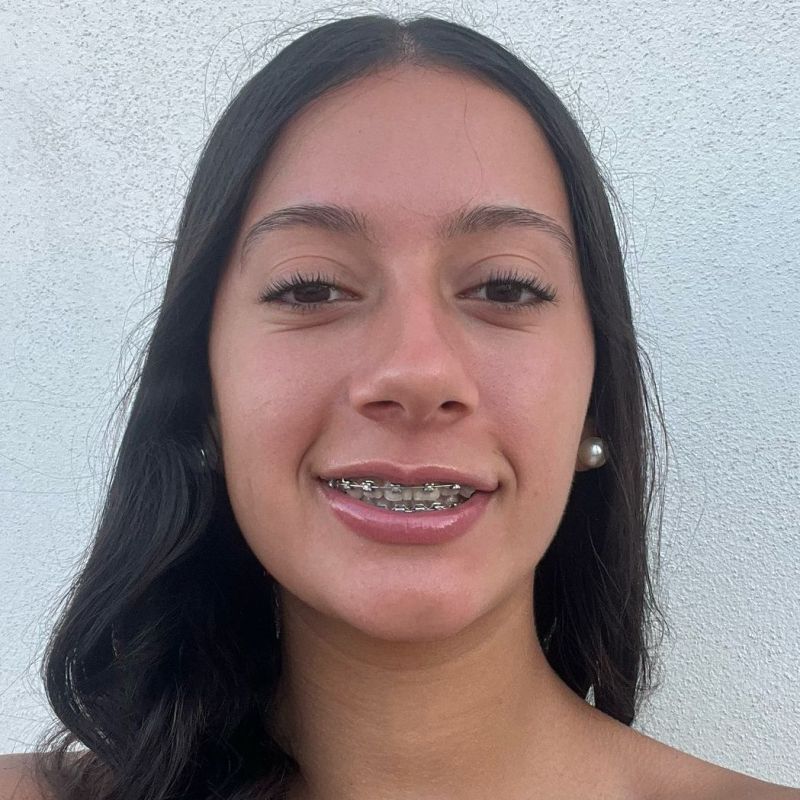 SARA SANCHEZ ABSELAM