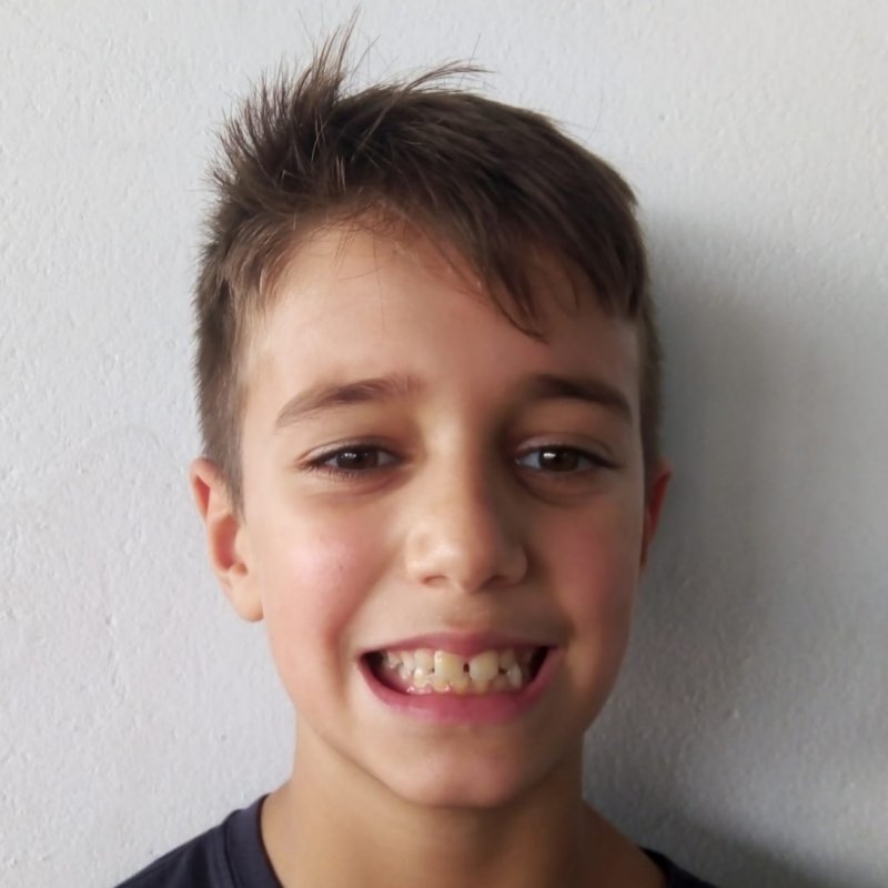 XABIER SOTELO VAZQUEZ