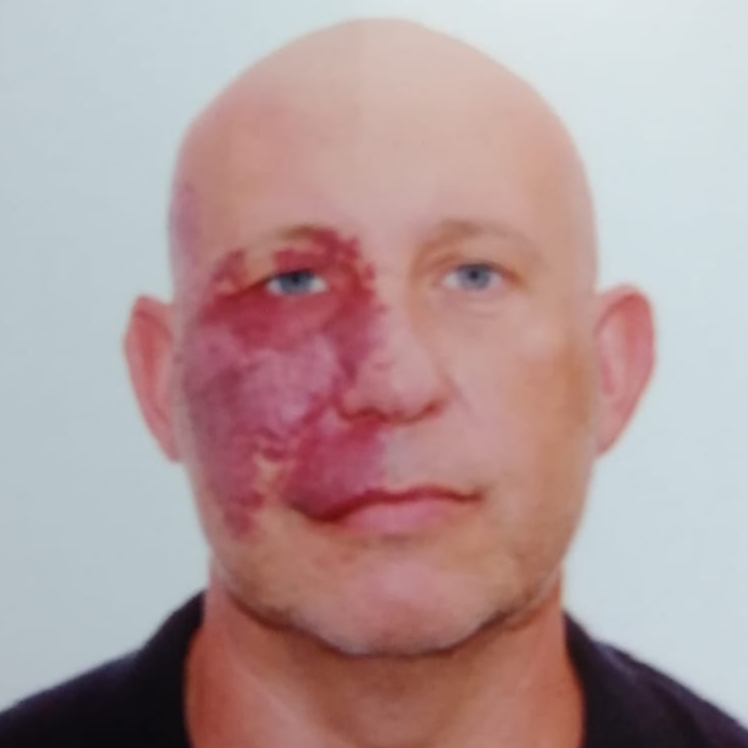 OSCAR FERNANDEZ ZAPATER