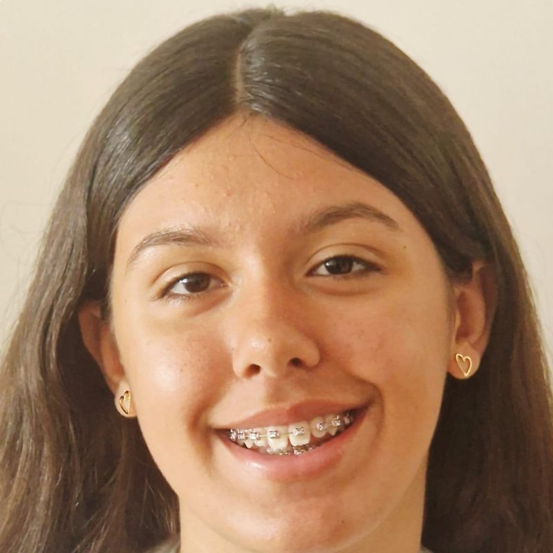 ELENA BURGAZZOLI  GONZALEZ