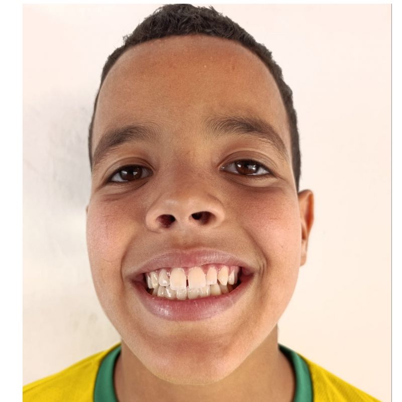 MBARK  CHAOUH EL MOUDNI