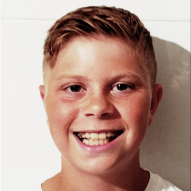 MATTIAS MOLINA SKOOG