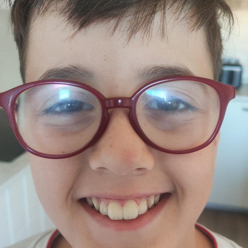 BEÑAT APELLANIZ ARMAÑANZAS