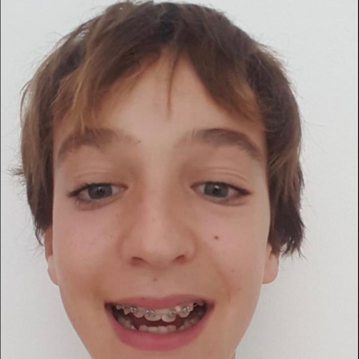 ERIC BERNADES GIMENEZ