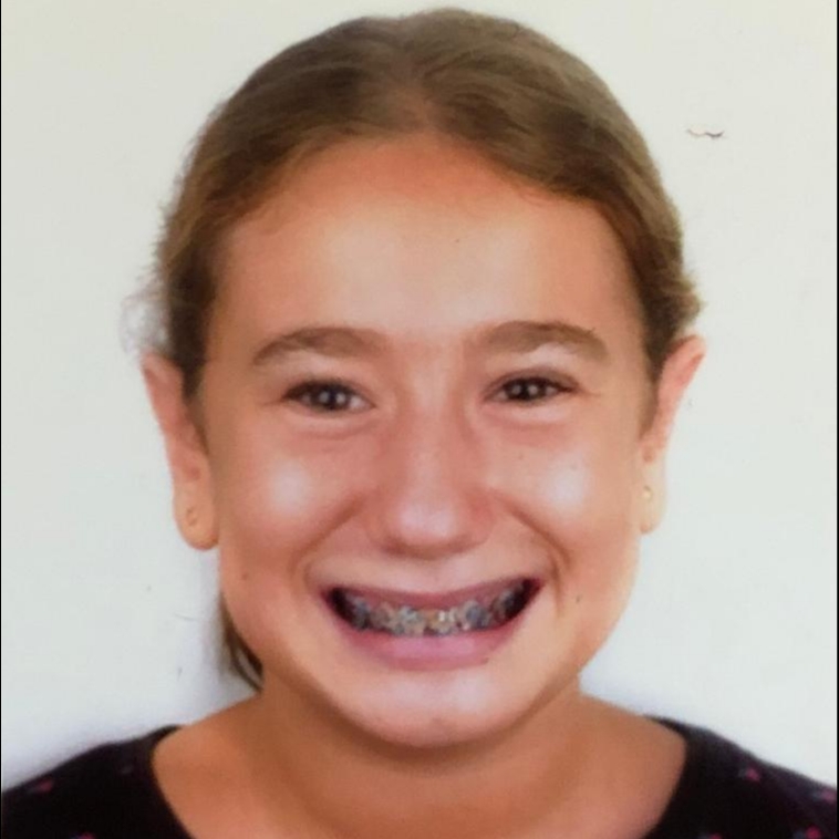 CANDELA MARTINEZ CABALLERO