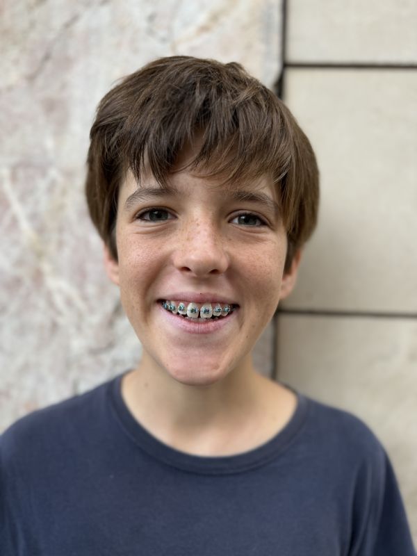 ALEX SCHYTTE PALAU